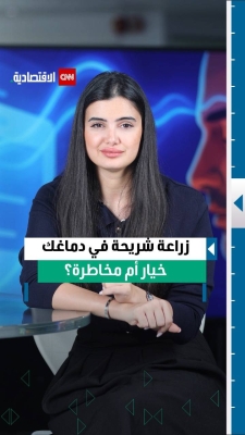 زراعة شريحة في دماغك